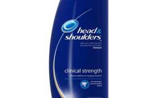 «Хеден Шолдерс» (шампунь). Head&Shoulders;: отзывы, состав, цена, результаты применения